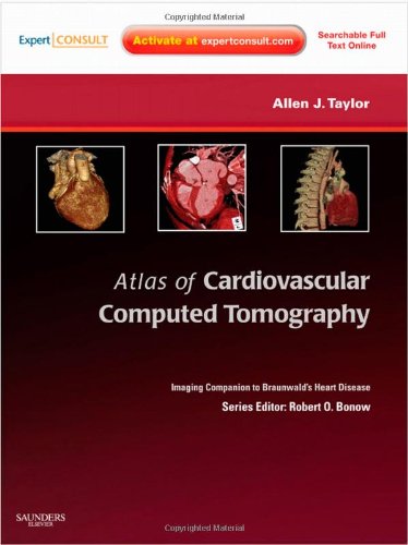 Atlas of Cardiovascular Computed Tomography: Expert Consult - Online and Print: Imaging Companion to Braunwald's Heart Disease (Imaging Techniques to Braunwald's Heart Disease)