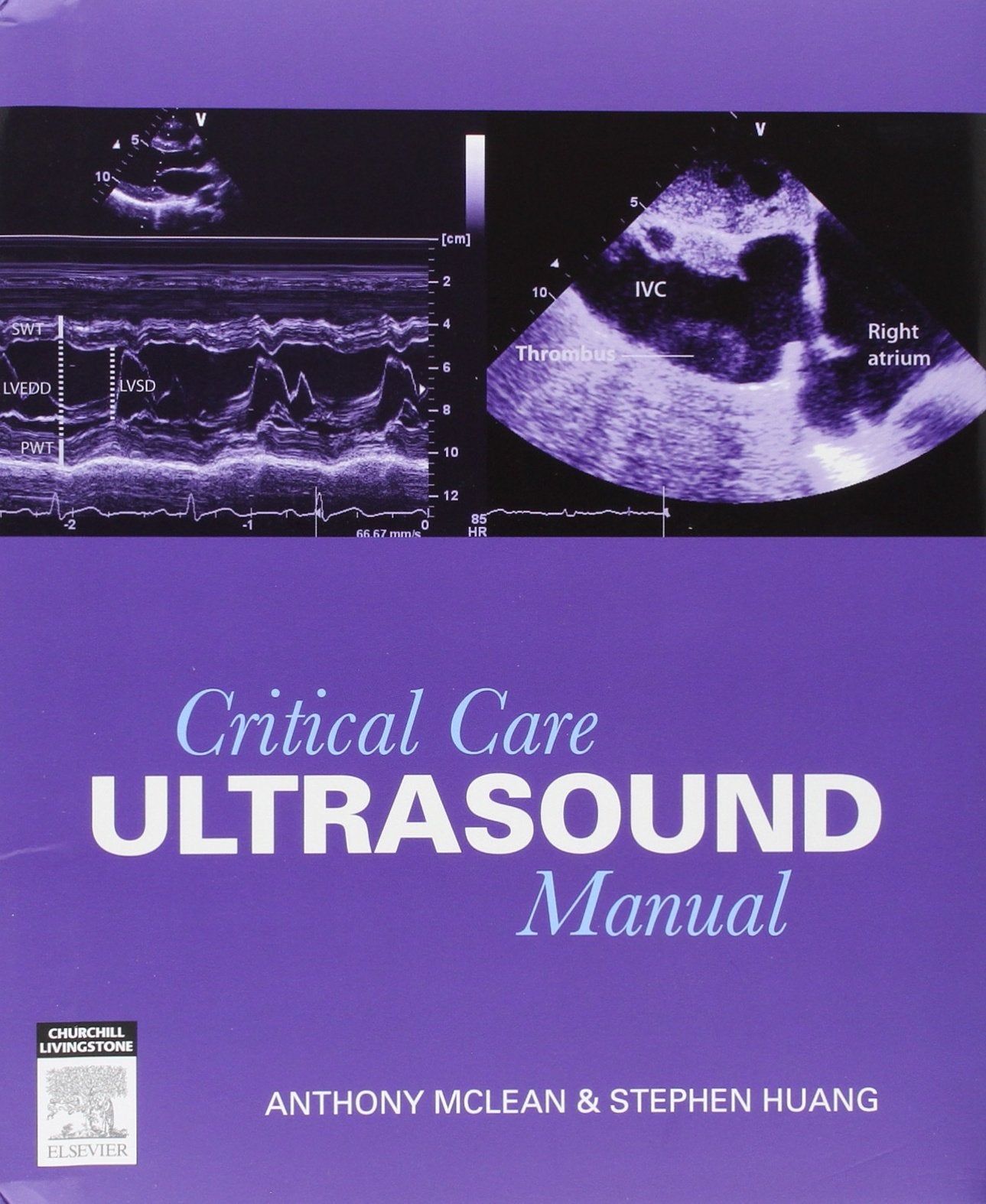 Critical Care Ultrasound Manual