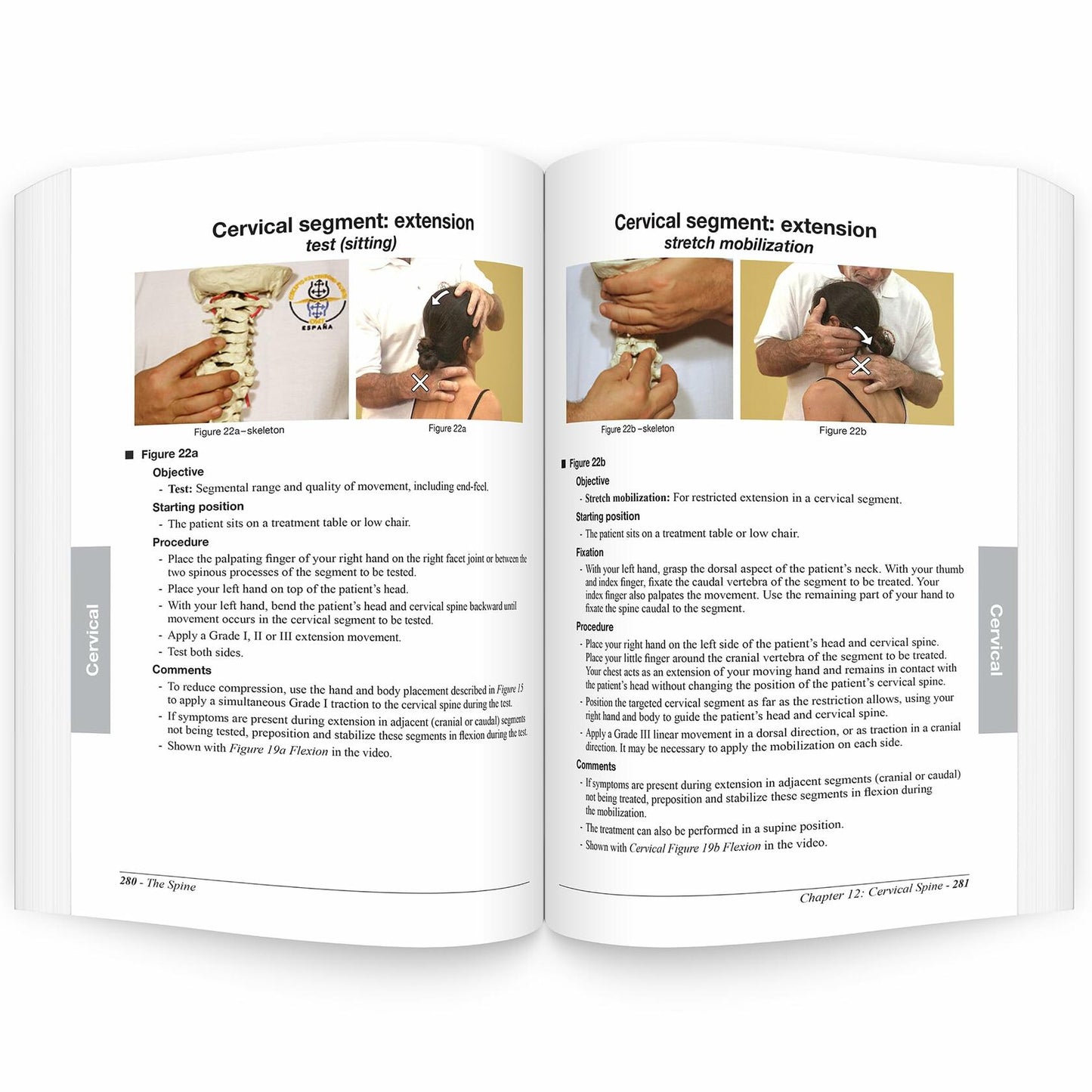 Manual Mobilization of the Joints, Volume II: The Spine