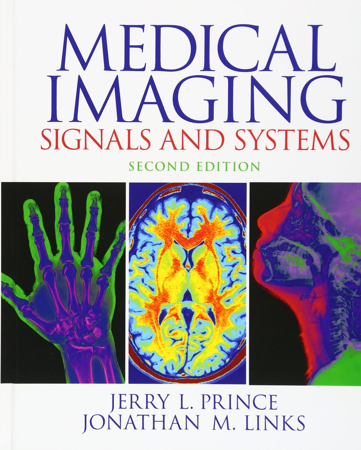 Medical Imaging Signals and Systems