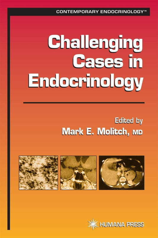Challenging Cases in Endocrinology (Contemporary Endocrinology)